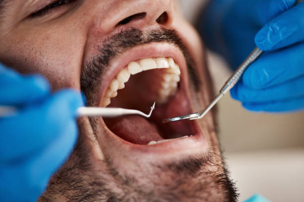 Best Emergency Tooth Extraction  in Tyrone, GA