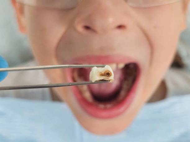 Best Dentist Open Late Near Me  in Tyrone, GA